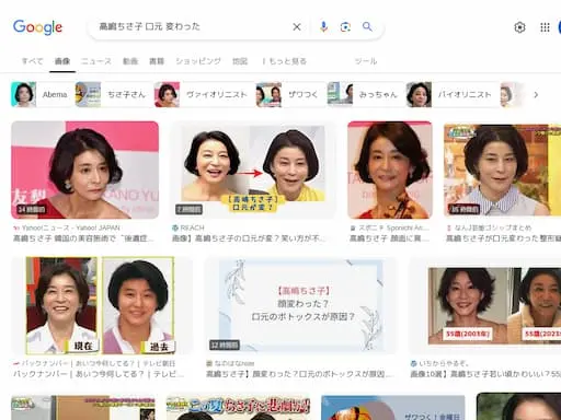 高嶋ちさ子の口元が変わった