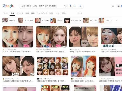 益若つばさ　口元　過去の写真との比較